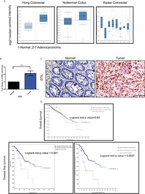 STIL Endows Oncogenic and Stem-Like Attributes to Colorectal Cancer Plausibly by Shh and Wnt Signaling